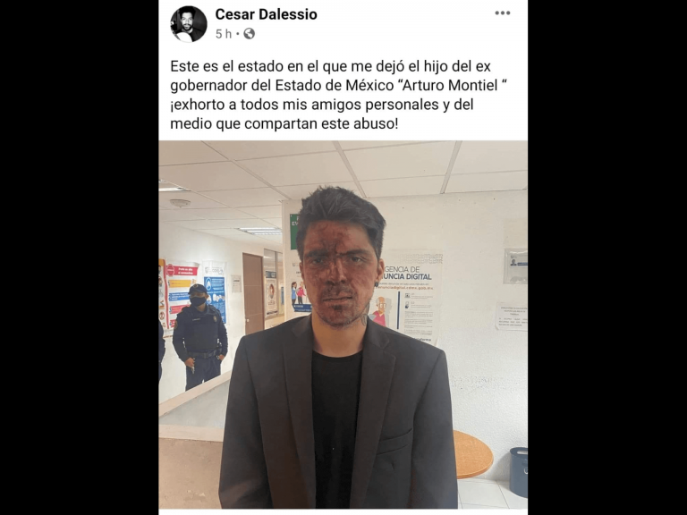 Golpean a César D’Alessio; culpa a “Arturo Montiel del PRI”